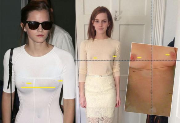 Emma Watson - leaked images